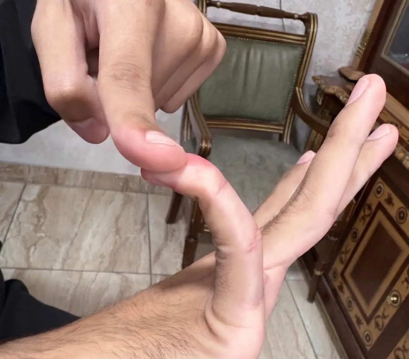 5 سنوات من العمليات والأوجاع.. تشخيص واحد كشف سرا وراثيا لعائلة أردنية